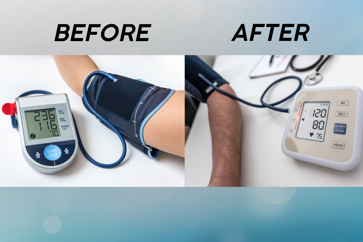 Before and After BP